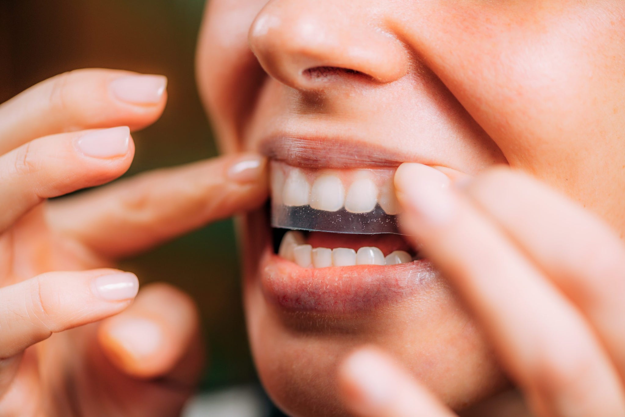 MySmile Strips